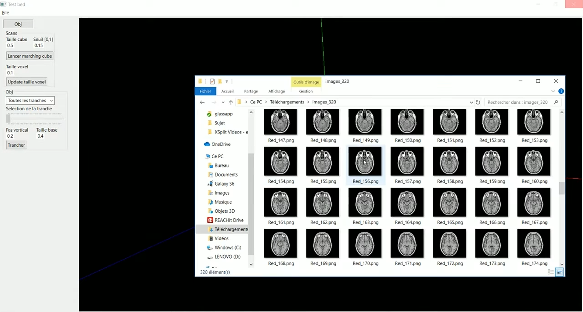 Visualisation 3D de scans médicaux