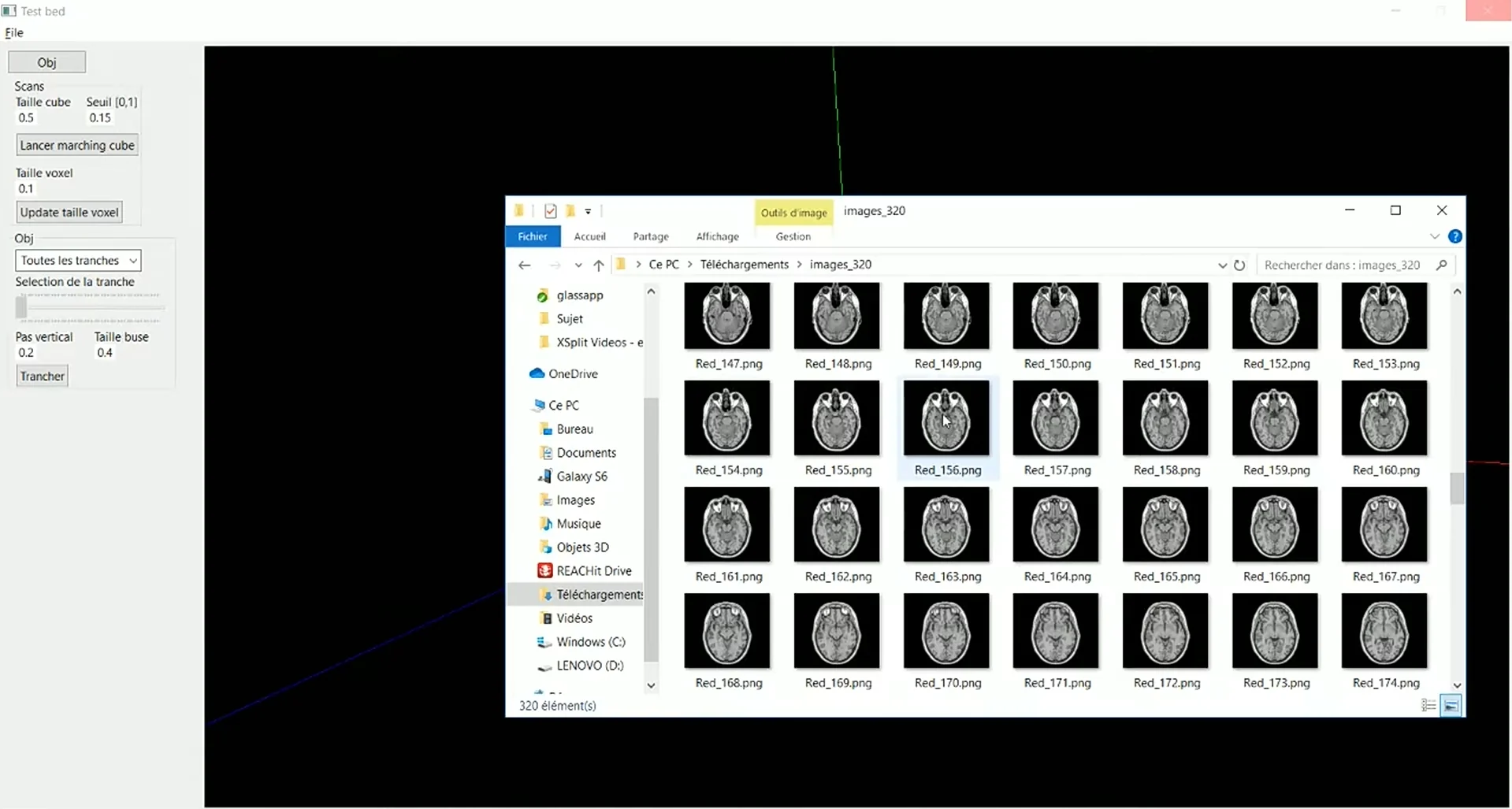 Visualisation 3D de scans médicaux